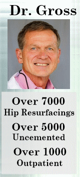 Dr. Gross of SC Hip Resurfacing Surgeon with over 6000 hip resurfacings