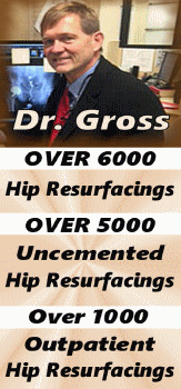 Dr. Gross of SC Hip Resurfacing Surgeon with over 6000 hip resurfacings