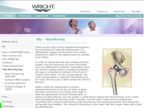 wrightdescription Wright Medical Conserve Plus Hip Resurfacing Device