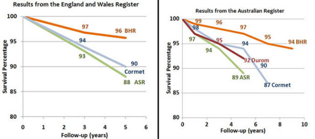 The Cormet 2000 hip resurfacing is also showing higher failure rates than the BHR in the UK Register. The Australian Joint Register shows higher than anticipated failure rates with the ASR, Durom, Cormet 2000 and Bionik resurfacings