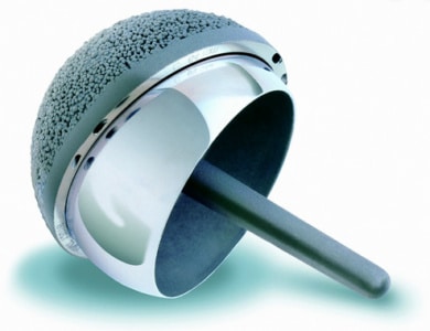 BHR Birmingham Hip Resurfacing