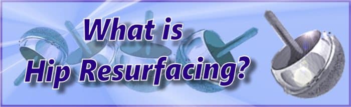 What is Hip Resurfacing