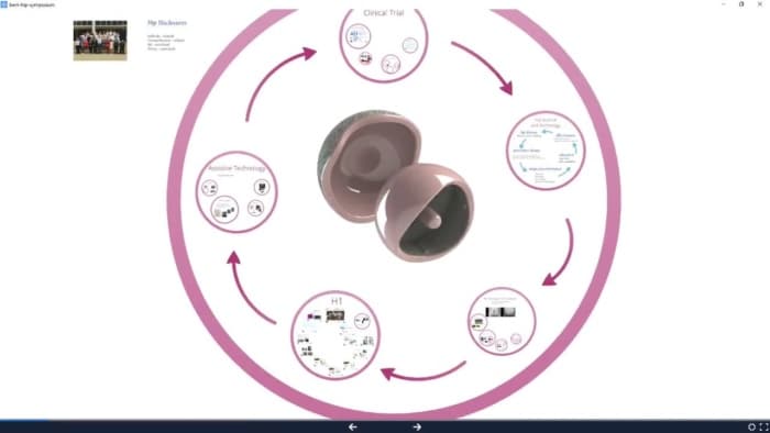 Professor Cobb Discusses H1 Ceramic-on-Ceramic Hip Resurfacing Device