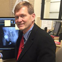 Dr. Gross Hip Resurfacing Surgeon with over 5000 Hip Resurfacings