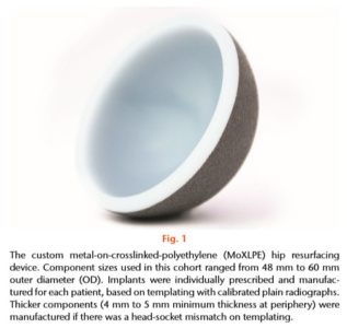 the custom metal-on-crosslinked-polyethylene (MoXlPe) hip resurfacing device by JointMedica