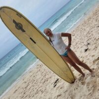 1 year bilateral recerf 2024b Hip Resurfacing Recovery Timeline: What to Expect Week by Week