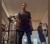 Pritesh Budu Mistry 3 Pritesh Budu Mistry Bilateral ReCerf Hip Resurfacing with Dr. De Smet 2025