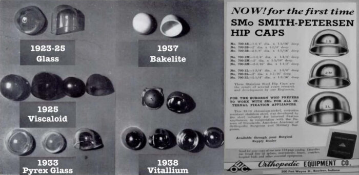 early hip replacement devices