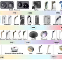 early hip replacement devices