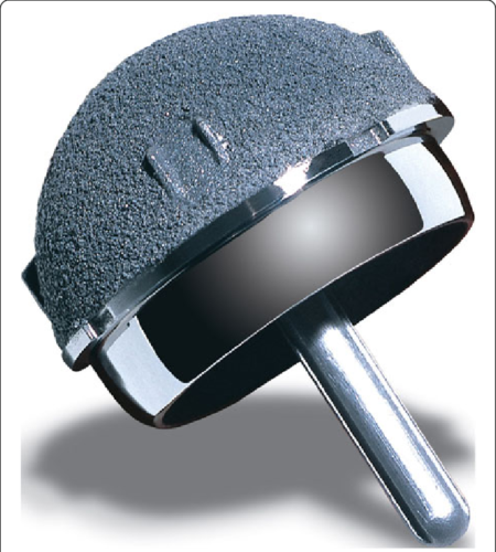 Recap/Magnum Hip Resurfacing Device