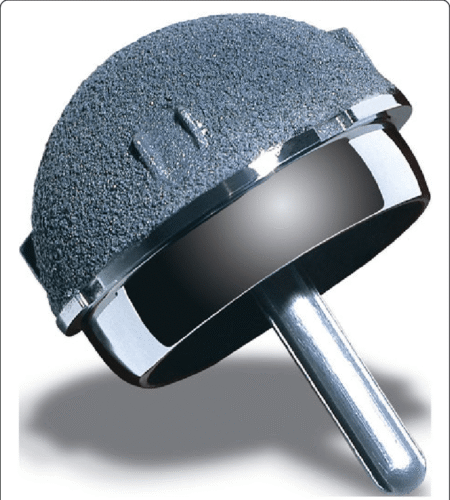 Recap/Magnum Hip Resurfacing Device